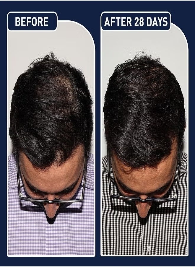 Hair Growth Spray 50ml