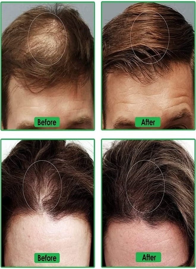 Hair Growth Spray 50ml