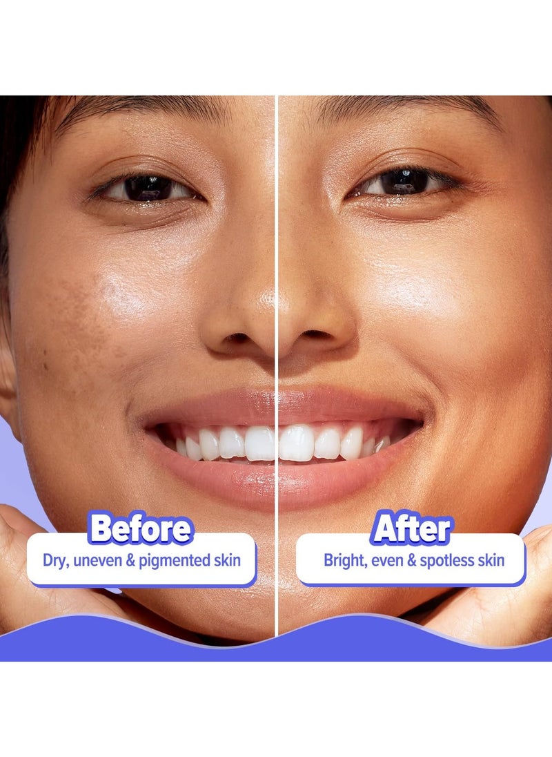 lluminate+ 20x* Alpha Arbutin Luminous Essence Serum - 50ml|Power of 20x* Alpha Arbutin | Fights Pigmentation & Uneven Skin Tone | Hydrates & Plumps Skin