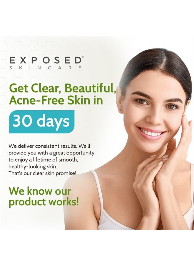 Basic Acne Treatment Kit - Includes Salicylic Acid Face Wash, Clearing Tonic, Acne Treatment Serum with Benzoyl Peroxide, Clear Pore Serum - Acne Set Solution for All Skin Types