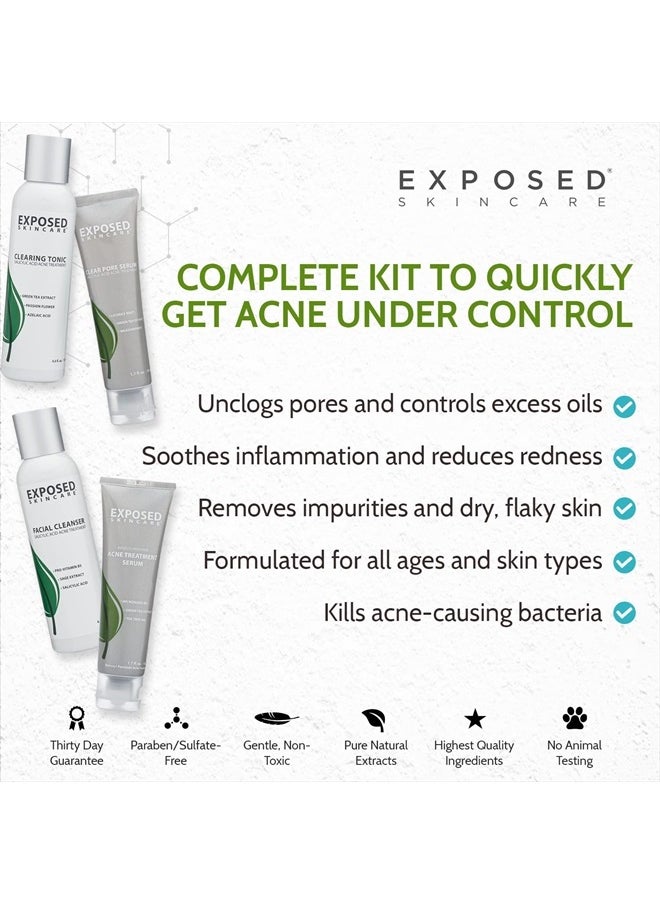 Basic Acne Treatment Kit - Includes Salicylic Acid Face Wash, Clearing Tonic, Acne Treatment Serum with Benzoyl Peroxide, Clear Pore Serum - Acne Set Solution for All Skin Types