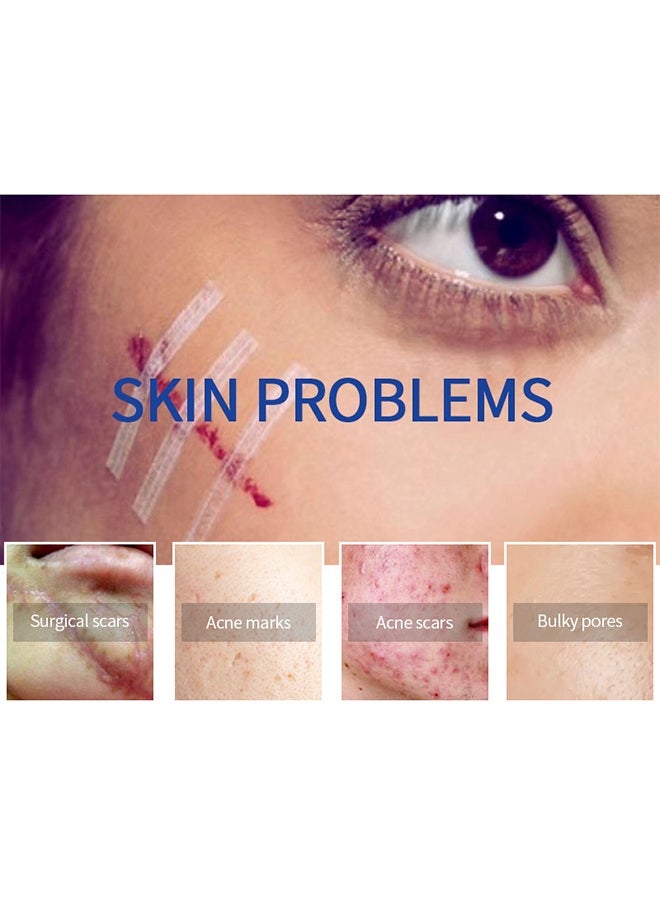 Scar Repair Cream， Facial And Body Scar Repair，Lightening Scars And Acne Marks， Using Natural Ingredients (30g)