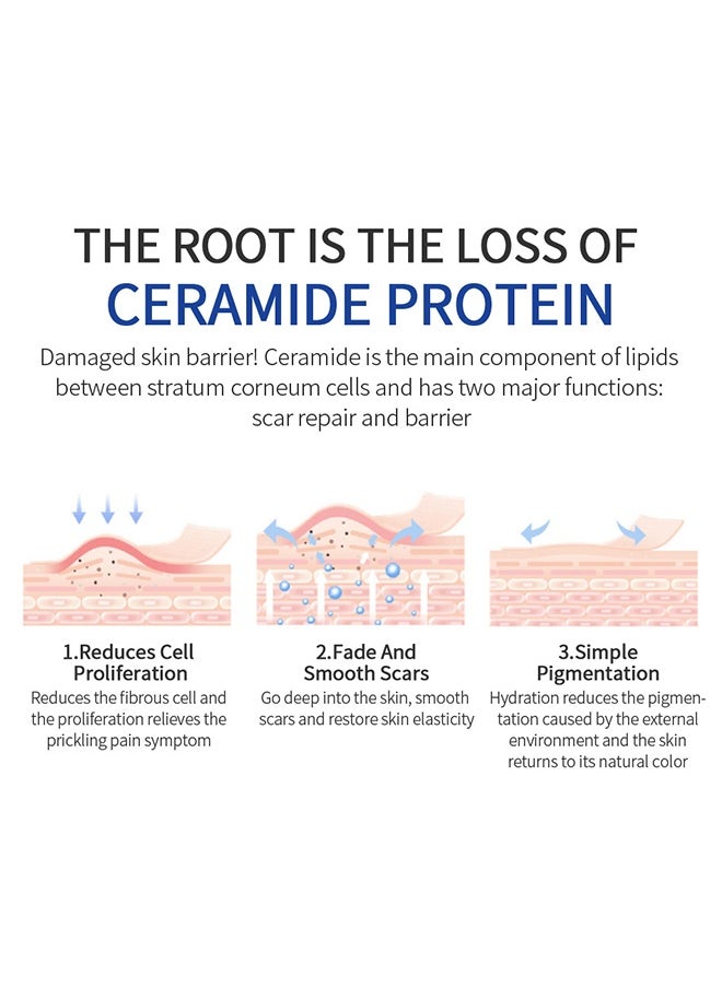 Scar Repair Cream， Facial And Body Scar Repair，Lightening Scars And Acne Marks， Using Natural Ingredients (30g)