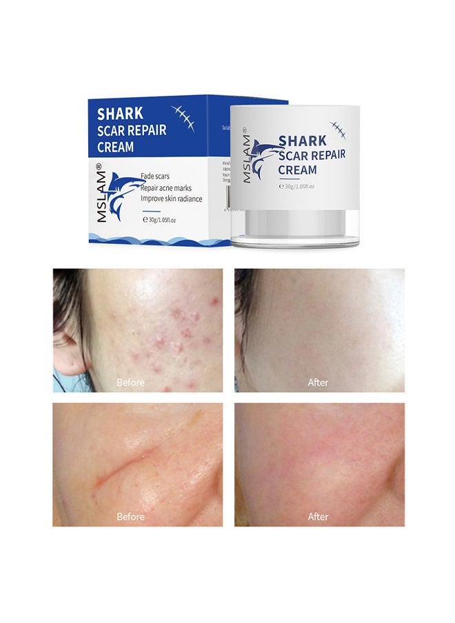 Scar Repair Cream， Facial And Body Scar Repair，Lightening Scars And Acne Marks， Using Natural Ingredients (30g)