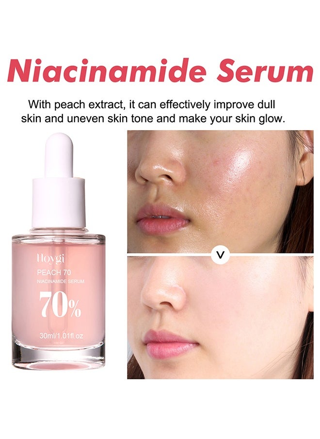 Peach 70 Niacinamide Serum 70%,Brightening Face Serum 30ml