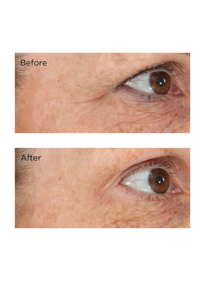 Essential Fx Acyl-Glutathione Eyelid Lift Serum, 0.5 fl. oz.