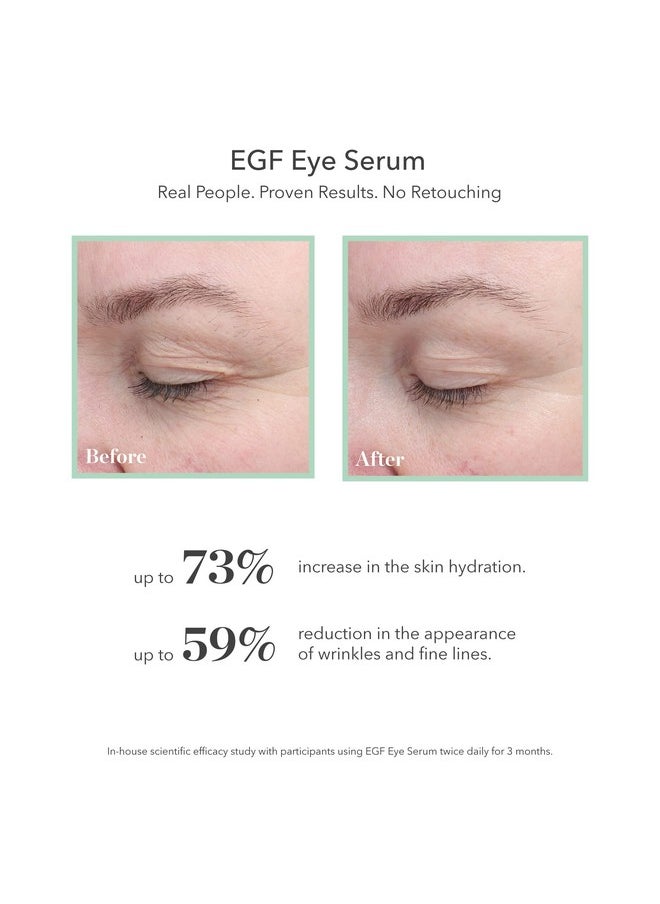 BIOEFFECT EGF Eye Serum with De-Puffer Rollerball, Anti-Aging, Moisturizing Contour Gel To Visibly Reduce Wrinkles, Puffiness, Fine Lines with Barley Growth-Factor Protein