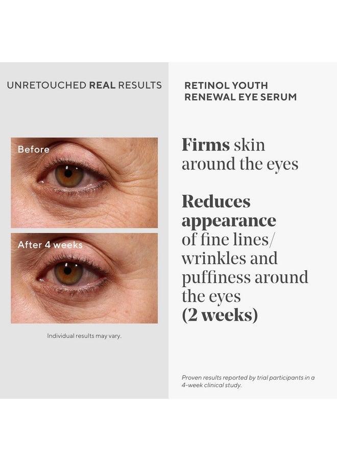 Murad Retinol Youth Renewal Eye Serum - Retinol Eye Serum Visibly Improves Undereye Puffiness Dark Circles and Reduces the Appearance of Fine Lines, Gentle Enough for Nightly Use - 0.5 oz