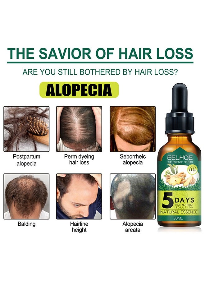 5 Days Hair Nutrient Solution，Hair Growth Serum, for Hair Fall Hair Regrowth And Scalp, Treatment Ginger Essential Oil Supports Healthy Hair Thinning Treatment Hair Growth Oil for Men 30 ML