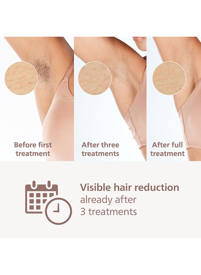 Lumea 9000 Series Ipl Hair laser Removal Device Smartskin Sensor Clinically Proven Performance, 4 Attachments BRI984/02, 60 Days Money Back Guarantee Rose Gold/White