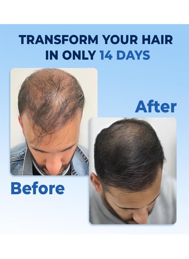 FEG PLUS Hair Growth Serum 50ml