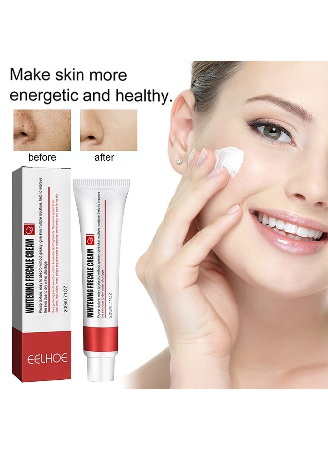 Whitening Freckle Cream,Pigmentation Removal Cream for Face,Freckle Remover Cream,Moisturizing Anti-blemish Cream,Dark Spots Remover Skin Whitening (20g)