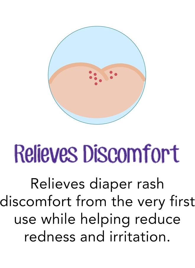Desitin Daily Defense Baby Diaper Rash Cream with Zinc Oxide to Treat, Relieve & Prevent diaper rash, Hypoallergenic, Dye-, Phthalate- & Paraben-Free, 4 oz