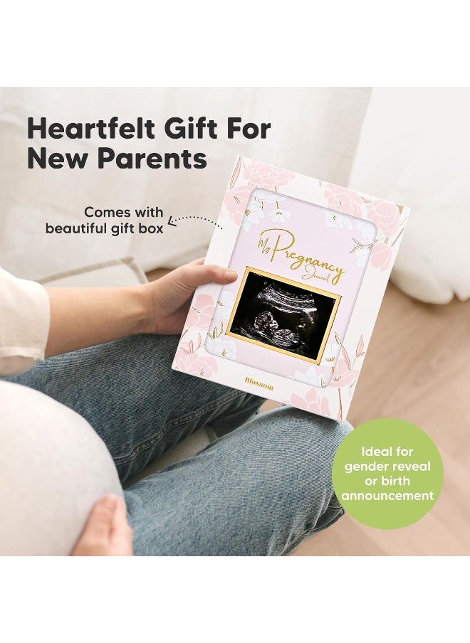 Pregnancy Journal, Pregnancy Announcements - 80 Pages Hard Cover Pregnancy Book For Mom To Be Gift - Pregnancy Gifts For New Moms - First Time Expecting Mom Gift - Baby Album And Memory Book (Blush)
