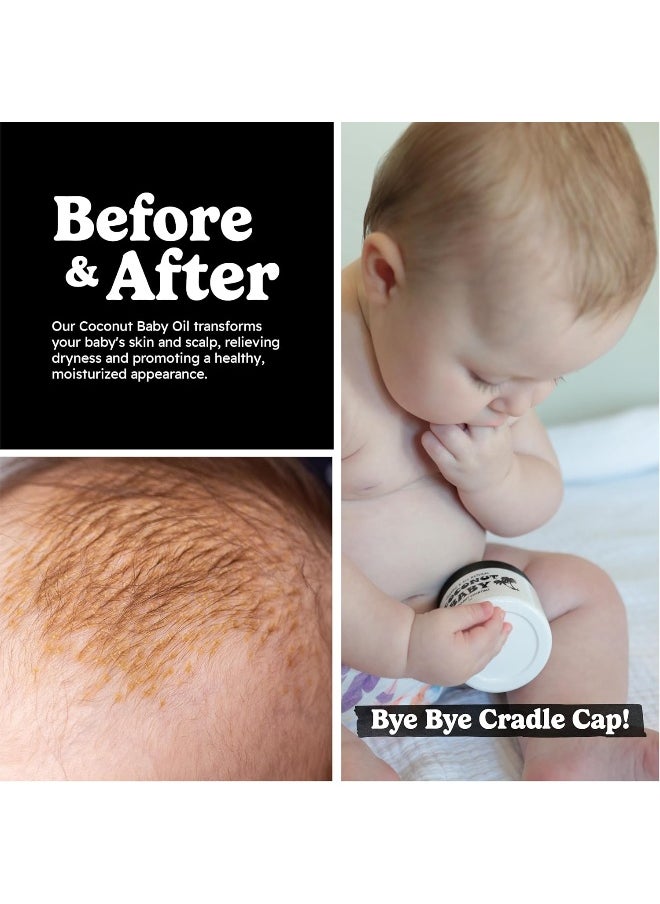 Coconut Essentials Baby Oil for Hair & Skin Care, Natural & Organic, Oil for Cradle Cap, and Infant Scalp Relief, Hair Oil for Adult and Newborn, Sensitive Skin Moisturizer, Unscented - 2 fl oz