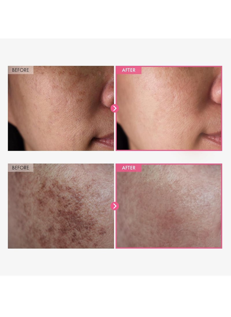 TOSOWOONG - Arbutin 5% Whitening Cream