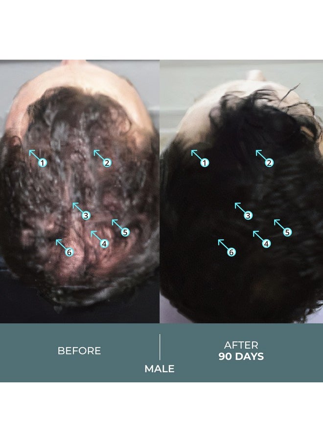 DS Laboratories Spectral.F7 Hair Serum - Regrowth Treatment With Astressin-B & Copper Peptides for Hair Growth, Thickening, and Loss Prevention for Men & Women