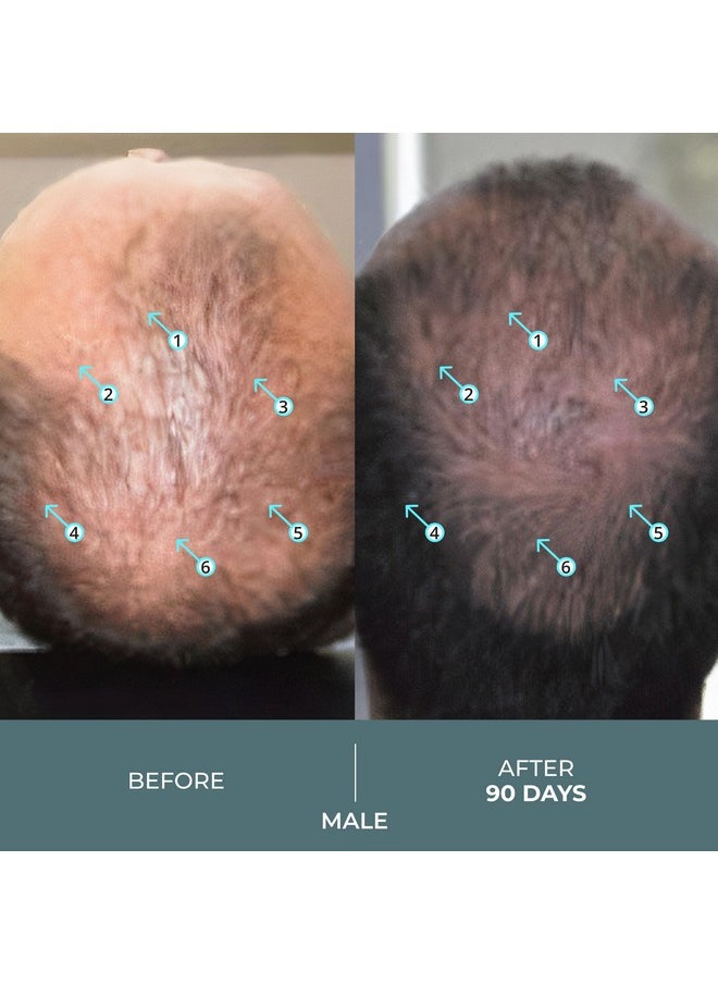 DS Laboratories Spectral.F7 Hair Serum - Regrowth Treatment With Astressin-B & Copper Peptides for Hair Growth, Thickening, and Loss Prevention for Men & Women