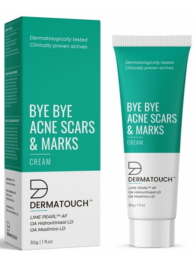 Bye Bye Acne Scars & Marks Cream || Acne Scars Corrector || Formulated Specially To Address Scars & Marks || Suitable For All Skin Types - 30G