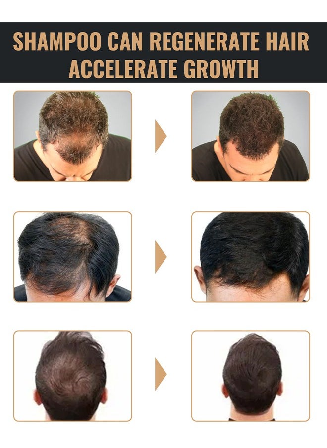 Hair Boost Shampoo - Spatan Root Activator Shampoo, Hair Regrowth Shampoos for Men & Beard, Natural Nourishing Formula to Promote Thicker, Fuller Hair – Repairing for Hair Loss & Scalp Health