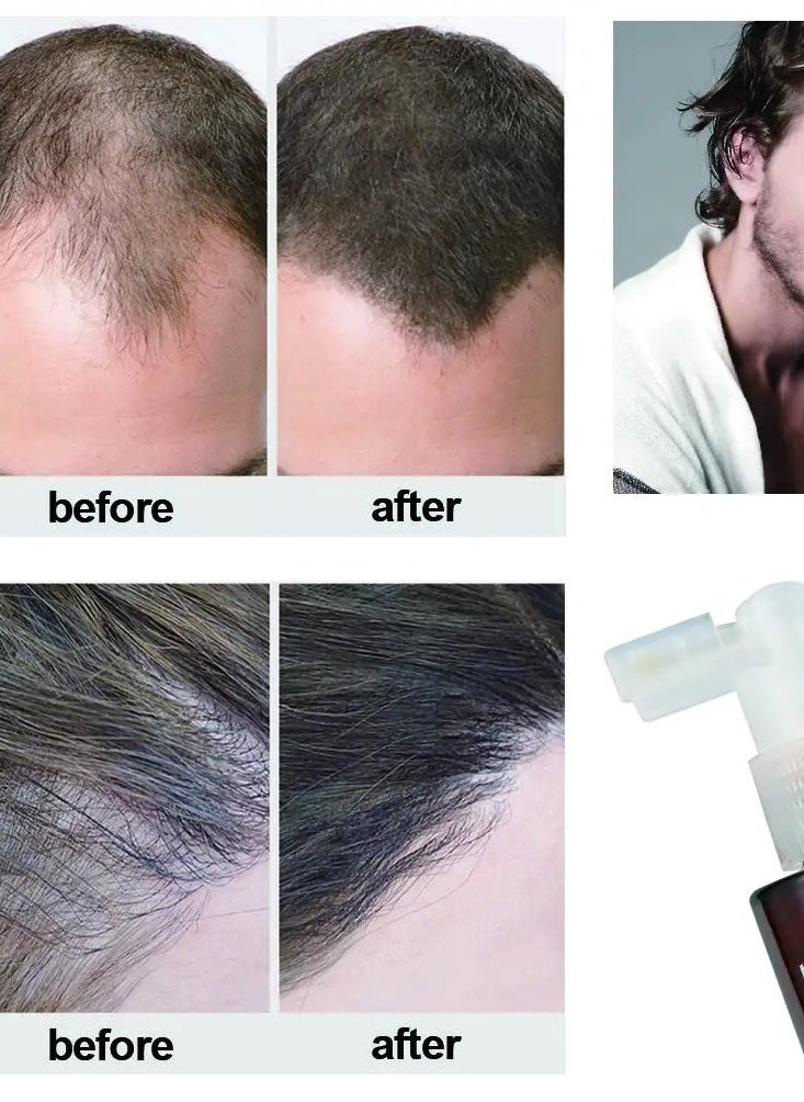 Maxcare Revitalizing Hair Tonic Clear – Anti Hair Fall Scalp Treatment – 120ml