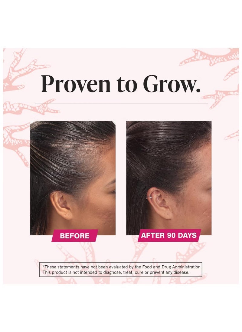Hair Growth Supplement for Women - 180 Tablets