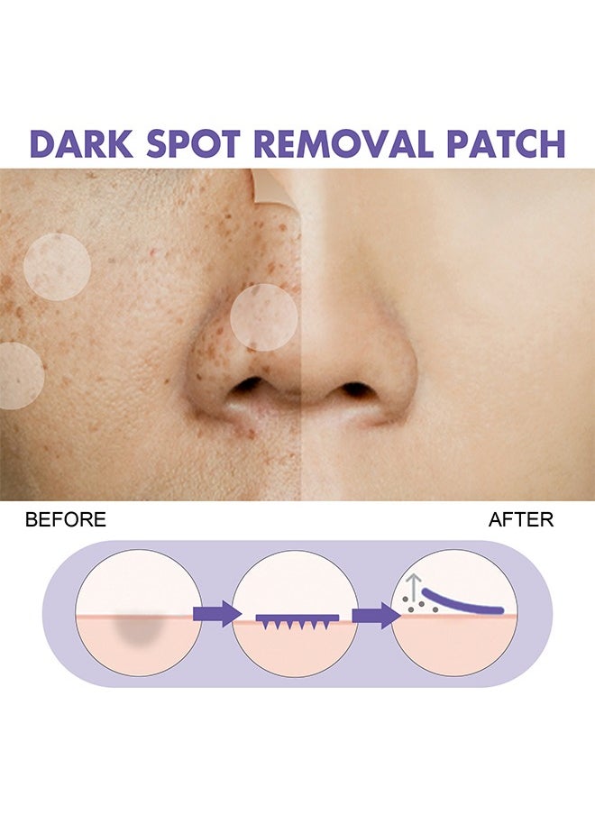 Dark Spot Removal Patch ,Spot Treatment for Face, Fast-Acting Dark Spot Corrector patch for Face and body Hyperpigmentation, Fades Melasma, Freckle, Sun Spots, Evens Skin Tone, Age Spot patch 144 patchs