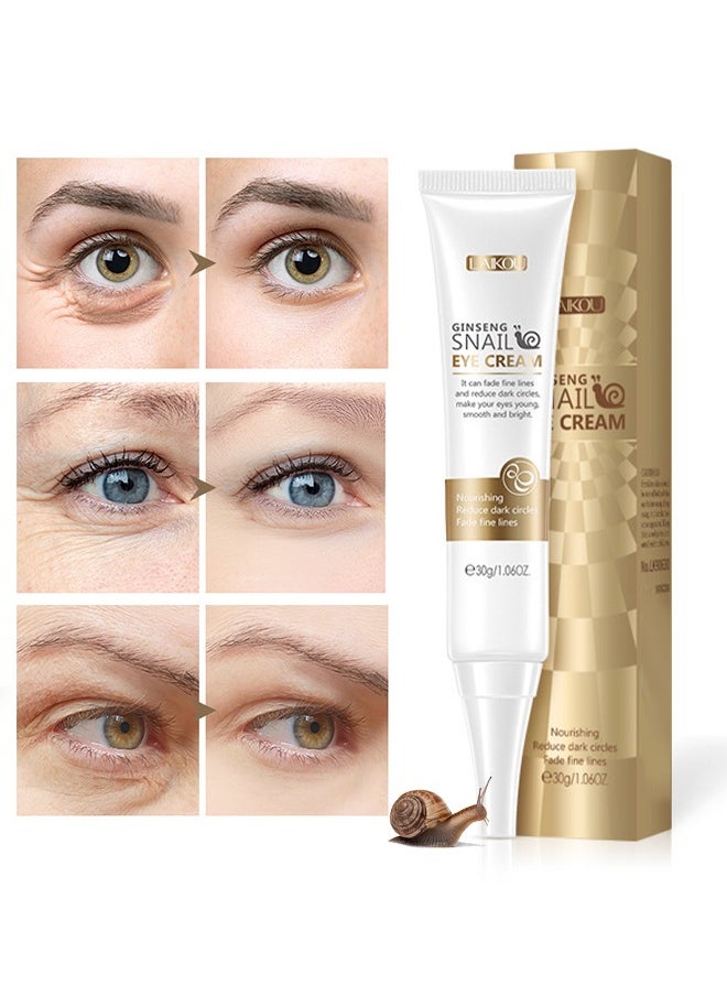 Ginseng Snail Eye Cream,Remove Dark Circle Anti-Aging Repair Eye Serum,Hydrating and Moisturising Effect Care for Skin Blooming Eyes Tight Firmer Gently Cleans Removes Dirt Oil 30g