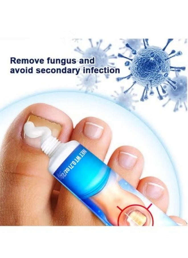 Nail Fungus Treatment Cream 20g, Bad Nail Care Ointment, Nail Fungus Treatment, Nail Growth and Repair, Nail Treatment Repair Cream