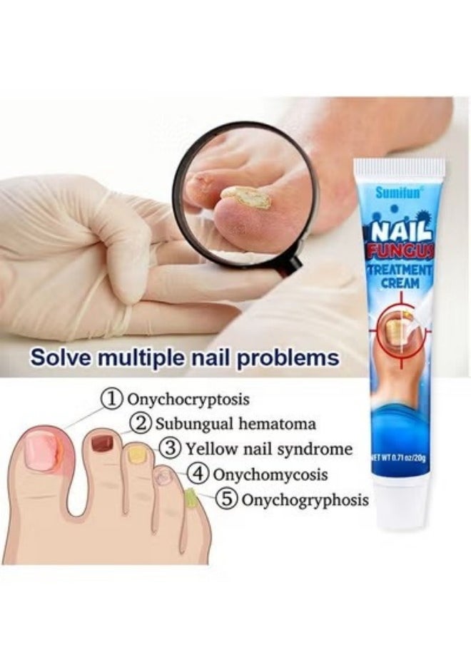 Nail Fungus Treatment Cream 20g, Bad Nail Care Ointment, Nail Fungus Treatment, Nail Growth and Repair, Nail Treatment Repair Cream