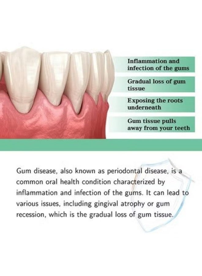 Gum Repair Drops 30ml, Rejuvenate Your Gums Drops, Natural Gum Restore Drops, Gum Regrowth for Receding Gums Drops, Gum Therapy Drops, Gingival Repair Drops, Gum Regrowth Drops, Oil Pulling for Gums
