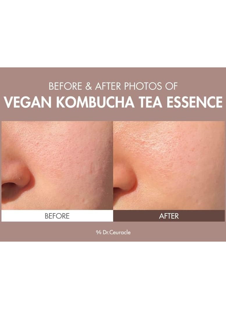 Dr. Ceuracle Vegan Kombucha Cream Essence, Cruelty Free The Most Effective All-In-One Serum Korean Skin Care Contains Kombucha, Tea Extract 78%, Camellia, Sunflower Seed Oil Not Tested On Animals