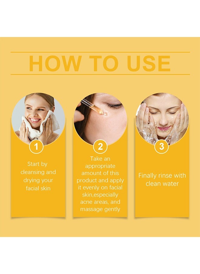 Turmeric Oil, Turmeric Dark Spot Correcting Serum Oil, Turmeric Repair Face Serum, Natural Turmeric Bright Skin Dark Spot Skin Care Moisturizing Repair Serum, Turmeric Oil for Face Dark Spots 30ml