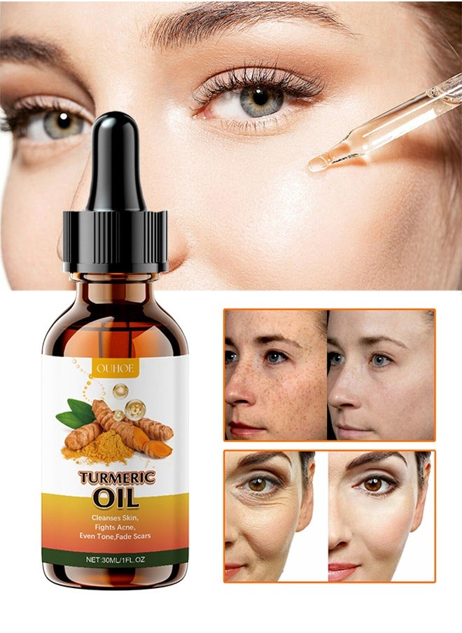 Turmeric Oil, Turmeric Dark Spot Correcting Serum Oil, Turmeric Repair Face Serum, Natural Turmeric Bright Skin Dark Spot Skin Care Moisturizing Repair Serum, Turmeric Oil for Face Dark Spots 30ml