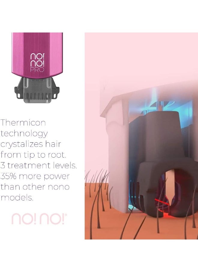 no!no! Pro Hair Removal Device Basic Kit - System With Buffer and Tip Attachments for Women & Men - Flawless Remover for Face & Body
