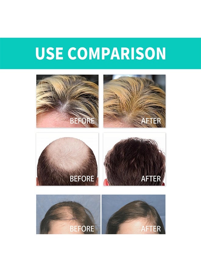 Nmn Hair Growth Roller,Thick Hair Roller Essence, Hair Root Thick Hairline Strengthening,Hair Care Firming,Hair Anti Fall Hair Essence 18ml
