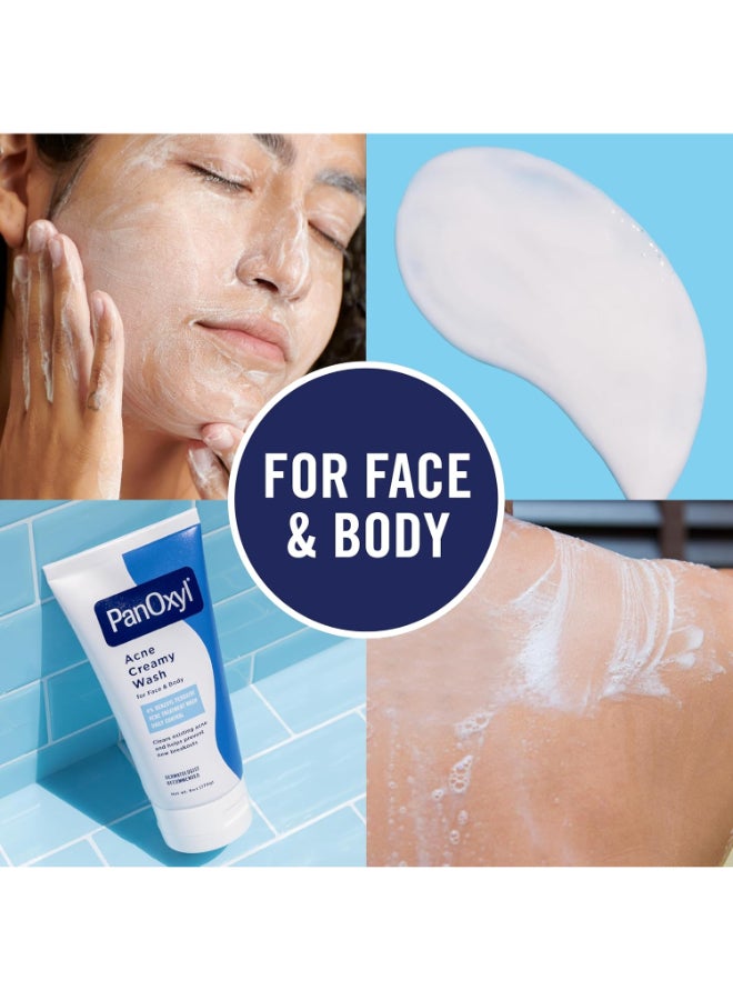 Acne Creamy Wash, 4% Benzoyl Peroxide, 6 Oz