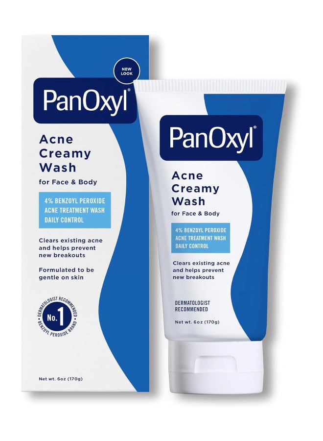 Acne Creamy Wash, 4% Benzoyl Peroxide, 6 Oz White 170grams