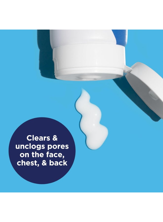 Acne Creamy Wash, 4% Benzoyl Peroxide, 6 Oz White 170grams