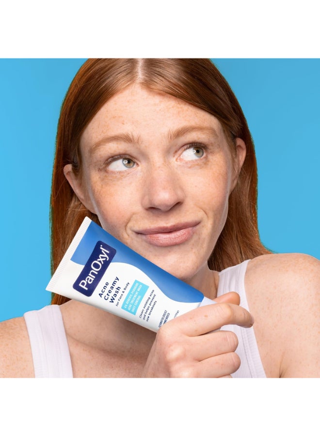 Acne Creamy Wash, 4% Benzoyl Peroxide, 6 Oz White 170grams