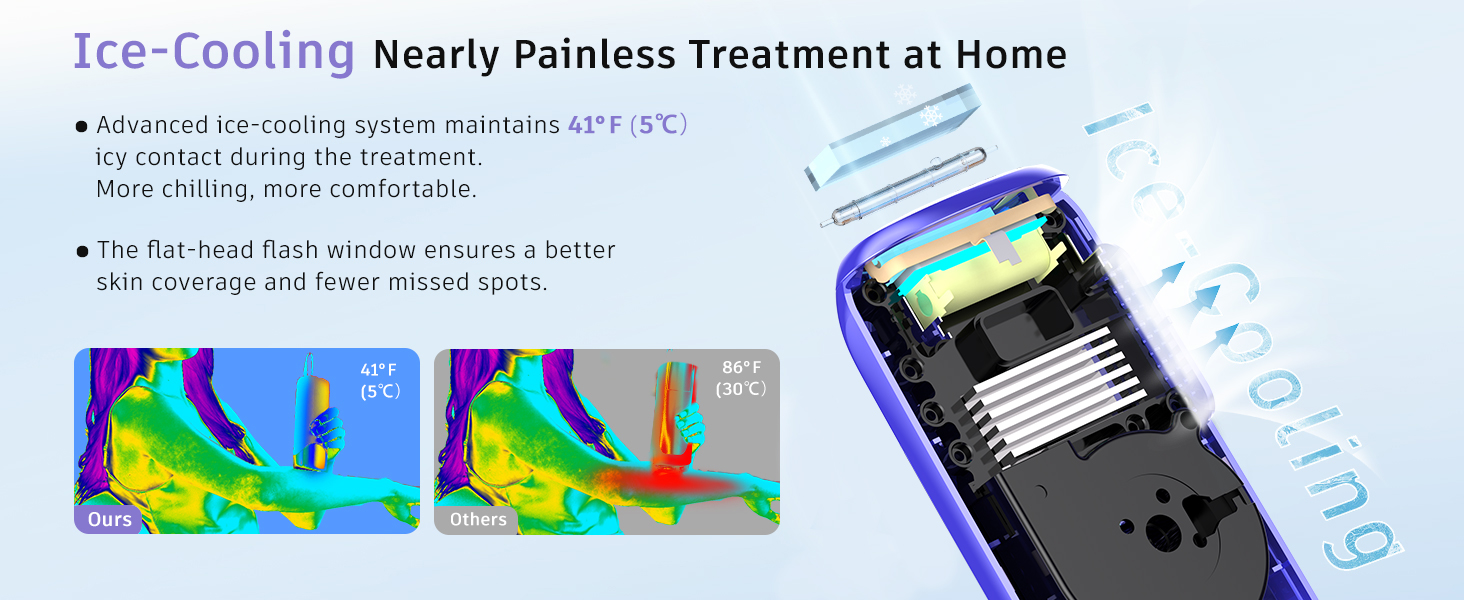 Laser Hair Removal Device for Women, Ice-Cooling IPL Device Hair Removal for Nearly Painless & Long-Lasting Results, 2 Modes – Manual & Auto Flashing for Fast Full Body Hair Removal from Home, professional quality