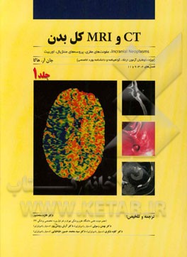 CT و MRI کل بدن: incranial neoplasms، عفونت های مغزی، پروسه های مننژیال، اوربیت ...