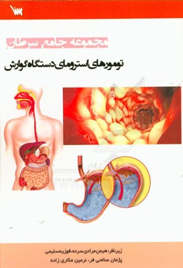 تومورهای استرومای دستگاه گوارش