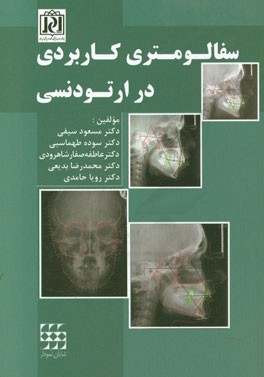 سفالومتری کاربردی در ارتودنسی