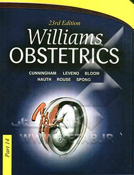 William's obstetrics - chapter 45-48: chronic hyportension