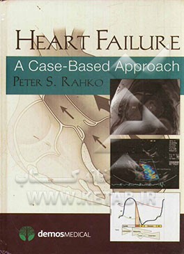 Heart failure: a case based approach