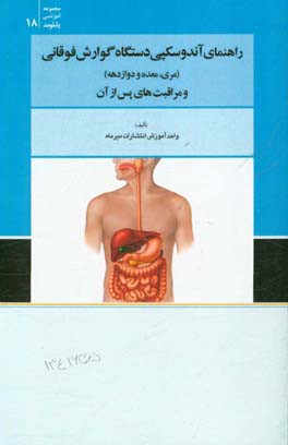 راهنمای آندوسکوپی دستگاه گوارش فوقانی (مری، معده و دوازدهه) و مراقبت های پس از آن