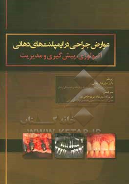 عوارض جراحی در ایمپلنت های دهانی: اتیولوژی، پیش گیری و مدیریت