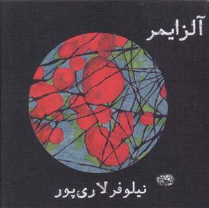 آلزایمر