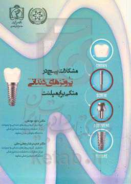 مشکلات پیچ در پروتزهای دندانی متکی بر ایمپلنت